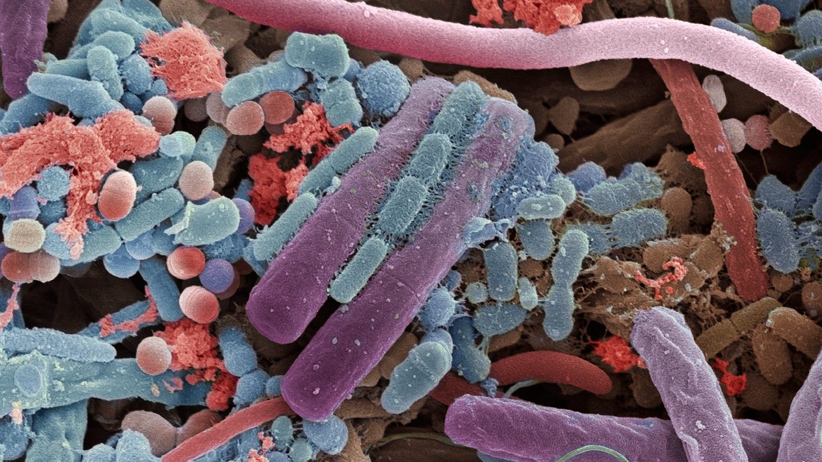 colorized electron microscopy of gut microbiota