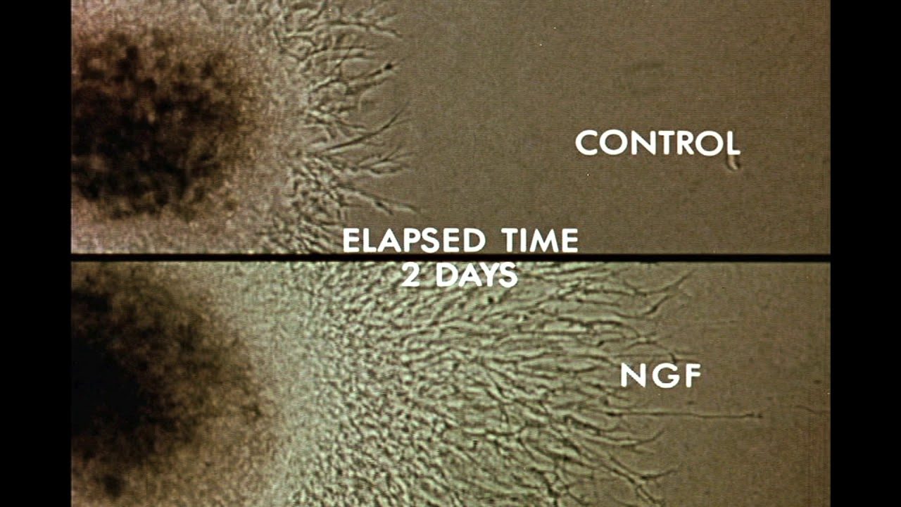 time lapse video of nerve growth in NGF growth medium