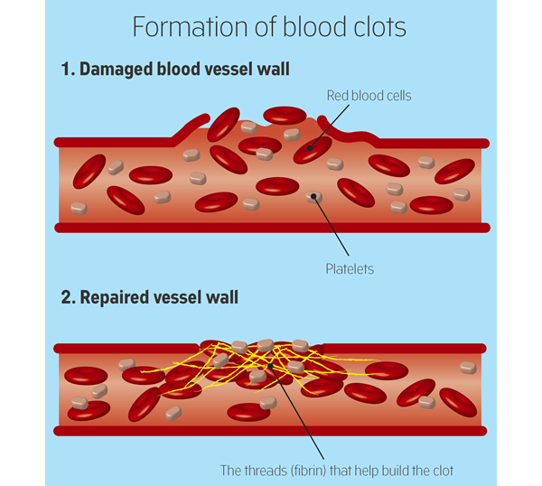 infographic on blood clotting
