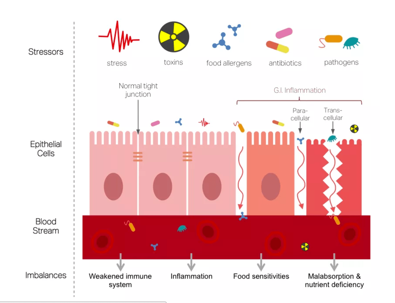 gut dysbiosis leaky gut
