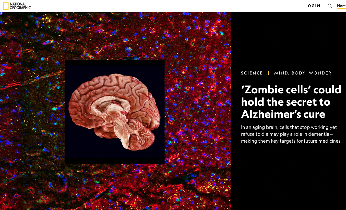 National geographic article title for zombie cells in Alzheimer's disease